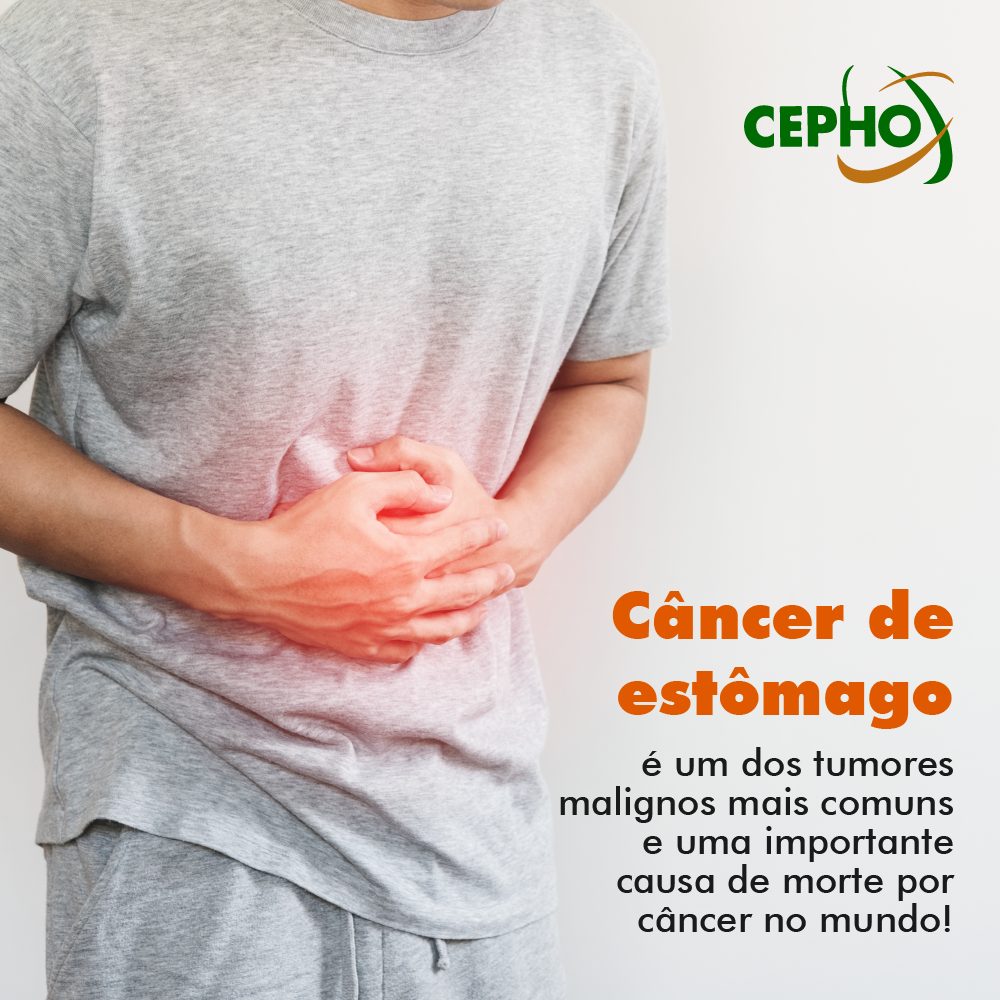 CEPHO - Câncer de estômago
