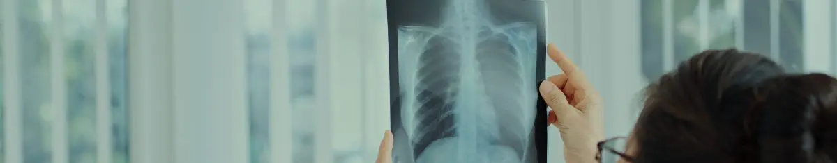 site-cepho-home -pacientes-oncologicos-estudos-ativos-banner-cancer-de-pulmao