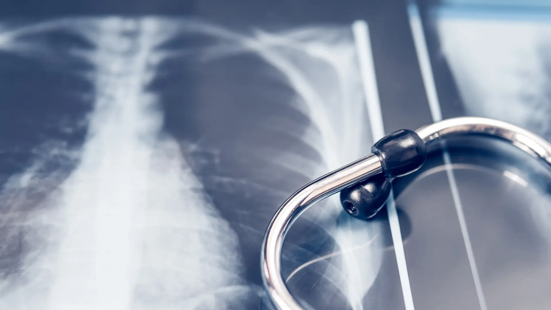 cepho-blog-cancer-de-pulmao